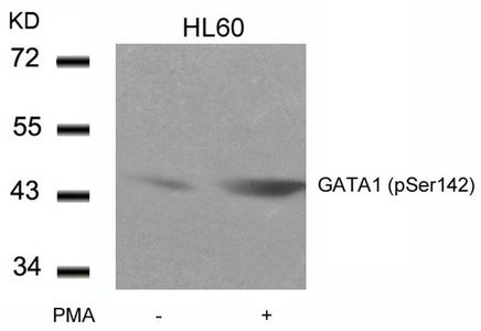Western blot analysis of extracts from HL60 cells untreated or treated with PMA using GATA1(Phospho-Ser142) Antibody.Rabbit anti-Human GATA1 Polyclonal Antibody