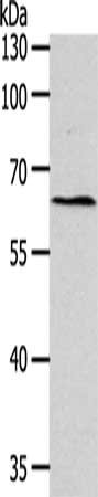 Gel: 10%SDS-PAGE, Lysate: 40 μg, Lane: SKOV3 cells, Primary antibody: SYT7 Antibody(SYT7 Antibody) at dilution 1/200, Secondary antibody: Goat anti rabbit IgG at 1/8000 dilution, Exposure time: 5 minutesRabbit anti-Human SYT7 Polyclonal Antibody