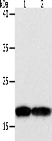 Gel: 10+12%SDS-PAGE, Lysate: 50 μg, Lane 1-2: Jurkat cells, hela cells, Primary antibody: PDCD6 Antibody(PDCD6 Antibody) at dilution 1/200, Secondary antibody: Goat anti rabbit IgG at 1/8000 dilution, Exposure time: 1 minuteRabbit anti-Human PDCD6 Polyclonal Antibody