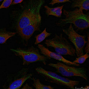 Immunofluorescence staining of methanol-fixed Hela cells using ADD1(Ab-726) Antibody.Rabbit anti-Human ADD1 Polyclonal Antibody