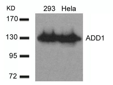 Western blot analysis of extracts from 293 and Hela cells using ADD1(Ab-726) Antibody.