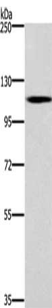 Gel: 6%SDS-PAGE, Lysate: 40 μg, Lane: Human fetal brain tissue, Primary antibody: CARD14 Antibody(CARD14 Antibody) at dilution 1/650, Secondary antibody: Goat anti rabbit IgG at 1/8000 dilution, Exposure time: 10 minutes