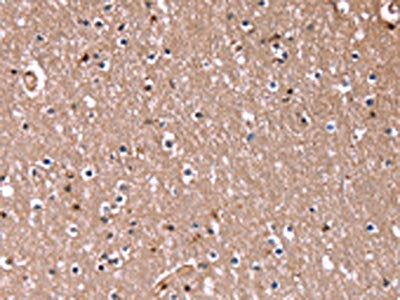 The image on the left is immunohistochemistry of paraffin-embedded Human brain  tissue using RDX Antibody(RDX Antibody) at dilution 1/60, on the right is treated with fusion protein. (Original magnification: ×200)Rabbit anti-Human RDX Polyclonal Antibody