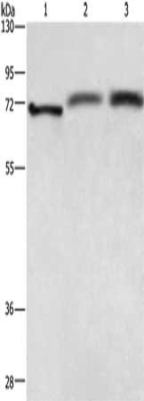 Gel: 6%SDS-PAGE, Lysate: 40 μg, Lane 1-3: Hela cells, human fetal brain tissue, Human hepatocellular carcinoma tissue, Primary antibody: RDX Antibody(RDX Antibody) at dilution 1/700, Secondary antibody: Goat anti rabbit IgG at 1/8000 dilution, Exposure time: 5 secondsRabbit anti-Human RDX Polyclonal Antibody