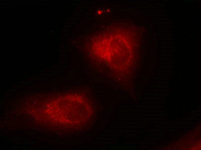 Immunofluorescence staining of methanol-fixed Hela cells using IkB-a(Ab-32/36) Antibody.Rabbit anti-Human NFKBIA Polyclonal Antibody