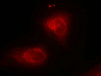 Immunofluorescence staining of methanol-fixed Hela cells using IkB-a(Ab-32/36) Antibody.Rabbit anti-Human NFKBIA Polyclonal Antibody