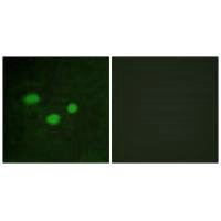 Immunofluorescence analysis of HeLa cells, using DNMT3B antibody.Rabbit anti-Human DNMT3B Polyclonal Antibody