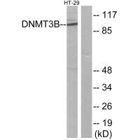 Western blot analysis of extracts from HT-29 cells, using DNMT3B antibody.Rabbit anti-Human DNMT3B Polyclonal Antibody
