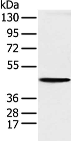 Gel: 8%SDS-PAGE, Lysate: 40μg, Lane: K562 cell, Primary antibody: KRT18 Antibody(KRT18 Antibody) at dilution 1/200 dilution, Secondary antibody: Goat anti rabbit IgG at 1/8000 dilution, Exposure time: 5 seconds