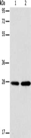Gel: 12%SDS-PAGE, Lysate: 40 μg, Lane 1-2: A172 cells, 231 cells, Primary antibody: BCAS2 Antibody(BCAS2 Antibody) at dilution 1/250, Secondary antibody: Goat anti rabbit IgG at 1/8000 dilution, Exposure time: 20 seconds