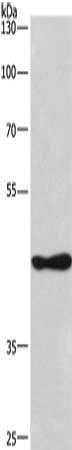 Gel: 8%SDS-PAGE, Lysate: 40 μg, Lane: 293T cells, Primary antibody: CSNK1D Antibody(CSNK1D Antibody) at dilution 1/270, Secondary antibody: Goat anti rabbit IgG at 1/8000 dilution, Exposure time: 5 minutesRabbit anti-Human CSNK1D Polyclonal Antibody