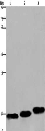 Gel: 8%SDS-PAGE, Lysate: 40 μg, Lane 1-3: Mouse skeletal muscle, Mouse heart tissue, Mouse bladder tissue, Primary antibody: MYL12B Antibody(MYL12B Antibody) at dilution 1/550, Secondary antibody: Goat anti rabbit IgG at 1/8000 dilution, Exposure time: 20 secondsRabbit anti-Human MYL12B Polyclonal Antibody