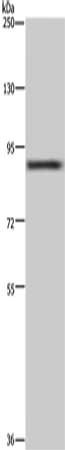 Gel: 6%SDS-PAGE, Lysate: 40 μg, Lane: 293T cells, Primary antibody: CUL3 Antibody(CUL3 Antibody) at dilution 1/250, Secondary antibody: Goat anti rabbit IgG at 1/8000 dilution, Exposure time: 20 secondsRabbit anti-Human CUL3 Polyclonal Antibody