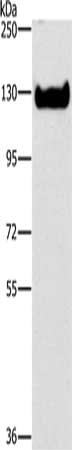 Gel: 6%SDS-PAGE, Lysate: 40 μg, Lane: Jurkat cells, Primary antibody: ICAM3 Antibody(ICAM3 Antibody) at dilution 1/348, Secondary antibody: Goat anti rabbit IgG at 1/8000 dilution, Exposure time: 1 minuteRabbit anti-Human ICAM3 Polyclonal Antibody