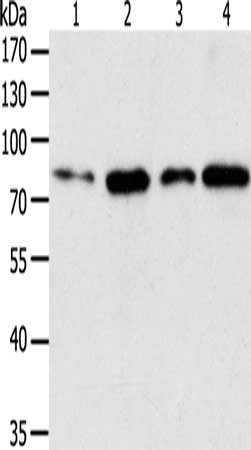 Gel: 10%SDS-PAGE, Lysate: 50 μg, Lane 1-4: Lovo cells, hela cells, human liver cancer tissue, Human fetal liver tissue, Primary antibody: TGM2 Antibody(TGM2 Antibody) at dilution 1/150, Secondary antibody: Goat anti rabbit IgG at 1/8000 dilution, Exposure time: 1 minuteRabbit anti-Human TGM2 Polyclonal Antibody