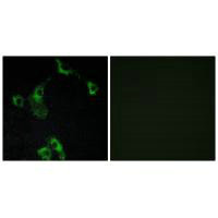 Immunofluorescence analysis of COS-7 cells, using CIDEB antibody.Rabbit anti-Human CIDEB Polyclonal Antibody