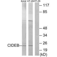 Western blot analysis of extracts from RAW264.7 cells and HT-29 cells, using CIDEB antibody.Rabbit anti-Human CIDEB Polyclonal Antibody