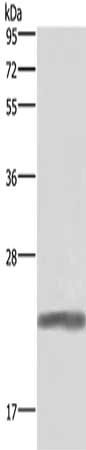 Gel: 10%SDS-PAGE, Lysate: 40 μg, Lane: Human placenta tissue, Primary antibody: GH1 Antibody(GH1 Antibody) at dilution 1/500, Secondary antibody: Goat anti rabbit IgG at 1/8000 dilution, Exposure time: 1 secondRabbit anti-Human GH1 Polyclonal Antibody