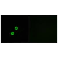 Immunofluorescence analysis of MCF-7 cells, using GCNT7 antibody.Rabbit anti-Human GCNT7 Polyclonal Antibody