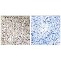 Immunohistochemistry analysis of paraffin-embedded human ovary tissue using GCNT7 antibody.Rabbit anti-Human GCNT7 Polyclonal Antibody
