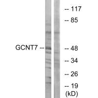 Western blot analysis of extracts from K562 cells, using GCNT7 antibody.Rabbit anti-Human GCNT7 Polyclonal Antibody