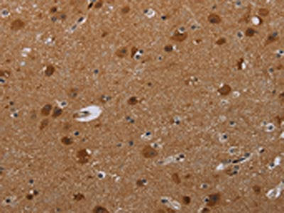 The image on the left is immunohistochemistry of paraffin-embedded Human brain  tissue using MIG7 Antibody(MIG7   Antibody) at dilution 1/20, on the right is treated with synthetic peptide. (Original magnification: ×200)