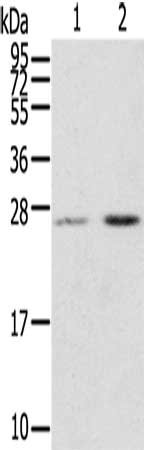 Gel: 12%SDS-PAGE, Lysate: 40 μg, Lane 1-2: Human placenta tissue, Human breast infiltrative duct tissue, Primary antibody: MIG7 Antibody(MIG7   Antibody) at dilution 1/200, Secondary antibody: Goat anti rabbit IgG at 1/8000 dilution, Exposure time: 15 seconds