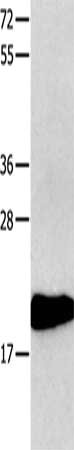 Gel: 10+12%SDS-PAGE, Lysate: 40 μg, Lane: 231 cells, Primary antibody: CMTM3 Antibody(CMTM3 Antibody) at dilution 1/350, Secondary antibody: Goat anti rabbit IgG at 1/8000 dilution, Exposure time: 1 minuteRabbit anti-Human CMTM3 Polyclonal Antibody