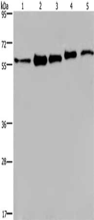 Gel: 6%SDS-PAGE, Lysate: 40 μg, Lane 1-5: MCF7 cells, 293T cells, A549 cells, Hela cells, HepG2 cells, Primary antibody: HNRNPL Antibody(HNRNPL Antibody) at dilution 1/450, Secondary antibody: Goat anti rabbit IgG at 1/8000 dilution, Exposure time: 40 secondsRabbit anti-Human HNRNPL Polyclonal Antibody