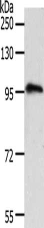 Gel: 8%SDS-PAGE, Lysate: 40 μg, Lane: Human fetal brain tissue, Primary antibody: TRPC3 Antibody(TRPC3 Antibody) at dilution 1/1600, Secondary antibody: Goat anti rabbit IgG at 1/8000 dilution, Exposure time: 2 minutesRabbit anti-Human TRPC3 Polyclonal Antibody