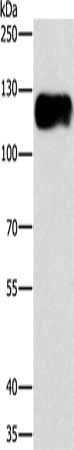 Gel: 8%SDS-PAGE, Lysate: 40 μg, Lane: Lovo cells, Primary antibody: CAST Antibody(CAST Antibody) at dilution 1/750, Secondary antibody: Goat anti rabbit IgG at 1/8000 dilution, Exposure time: 7 seconds