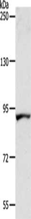 Gel: 8%SDS-PAGE, Lysate: 40 μg, Lane: Human fetal liver tissue, Primary antibody: ACAD11 Antibody(ACAD11 Antibody) at dilution 1/300, Secondary antibody: Goat anti rabbit IgG at 1/8000 dilution, Exposure time: 1 minute