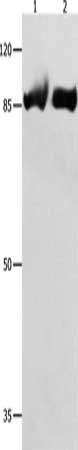 Gel: 8%SDS-PAGE, Lysate: 40 μg, Lane 1-2: Hela cells, 231 cells, Primary antibody: IMMT Antibody(IMMT Antibody) at dilution 1/250, Secondary antibody: Goat anti rabbit IgG at 1/8000 dilution, Exposure time: 1 minuteRabbit anti-Human IMMT Polyclonal Antibody