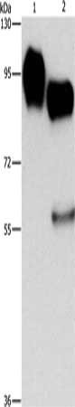 Gel: 10%SDS-PAGE, Lysate: 40 μg, Lane 1-2: Raji cells, huvec cells, Primary antibody: ICAM1 Antibody(ICAM1 Antibody) at dilution 1/1150, Secondary antibody: Goat anti rabbit IgG at 1/8000 dilution, Exposure time: 1 secondRabbit anti-Human ICAM1 Polyclonal Antibody