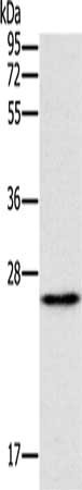 Gel: 10%SDS-PAGE, Lysate: 40 μg, Lane: Mouse heart tissue, Primary antibody: ERAS Antibody(ERAS Antibody) at dilution 1/450, Secondary antibody: Goat anti rabbit IgG at 1/8000 dilution, Exposure time: 1 minuteRabbit anti-Human ERAS Polyclonal Antibody