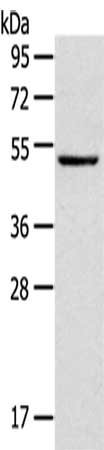 Gel: 8%SDS-PAGE,Lysate: 40 μg,,Primary antibody: TRIM49 Antibody(TRIM49 Antibody) at dilution 1/800 dilution,Secondary antibody: Goat anti rabbit IgG at 1/8000 dilution,Exposure time: 3 secondsRabbit anti-Human TRIM49 Polyclonal Antibody