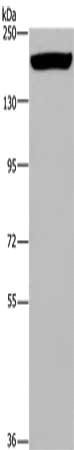 Gel: 6%SDS-PAGE, Lysate: 50 μg, Lane: Mouse heart tissue, Primary antibody: ARFGEF2 Antibody(ARFGEF2 Antibody) at dilution 1/200, Secondary antibody: Goat anti rabbit IgG at 1/8000 dilution, Exposure time: 5 minutesRabbit anti-Human ARFGEF2 Polyclonal Antibody