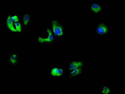 Immunofluorescence staining of MCF-7 cells with IL10RB Antibody at 1:66, counter-stained with DAPI. The cells were fixed in 4% formaldehyde, permeabilized using 0.2% Triton X-100 and blocked in 10% normal Goat Serum. The cells were then incubated with the antibody overnight at 4°C. The secondary antibody was Alexa Fluor 488-congugated AffiniPure Goat Anti-Rabbit IgG(H+L).Rabbit anti-Human IL10RB Polyclonal Antibody