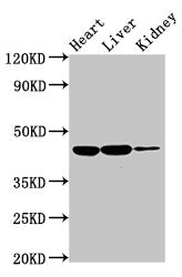 Western Blot | Positive WB detected in: Rat heart tissue, Rat liver tissue, Rat kidney tissue | All lanes: IL10RB antibody at 2μg/ml | Secondary | Goat polyclonal to rabbit IgG at 1/50000 dilution | Predicted band size: 37 kDa | Observed band size: 45 kDa