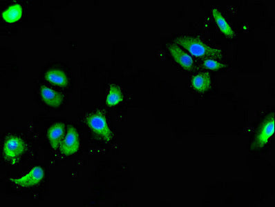 Immunofluorescent analysis of HepG2 cells using GOLGA3 Antibody at dilution of 1:100 and Alexa Fluor 488-congugated AffiniPure Goat Anti-Rabbit IgG(H+L)Rabbit anti-Human GOLGA3 Polyclonal Antibody
