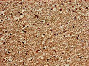 Immunohistochemistry of paraffin-embedded human brain tissue using the antibody at dilution of 1:100Rabbit anti-Human GOLGA3 Polyclonal Antibody