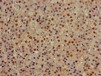 Immunohistochemistry of paraffin-embedded human adrenal gland tissue using GOLGA3 Antibody at dilution of 1:100Rabbit anti-Human GOLGA3 Polyclonal Antibody