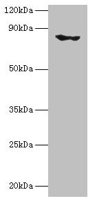 Western blot  | All lanes: EHHADH antibody at 2µg/ml + Mouse kidney tissue  | Secondary  | Goat polyclonal to rabbit IgG at 1/10000 dilution  | Predicted band size: 80, 70 kDa  | Observed band size: 80 kDaRabbit anti-Human EHHADH Polyclonal Antibody