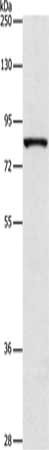 Gel: 8%SDS-PAGE, Lysate: 40 μg, Lane: A172 cells, Primary antibody: ARHGEF7 Antibody(ARHGEF7 Antibody) at dilution 1/800, Secondary antibody: Goat anti rabbit IgG at 1/8000 dilution, Exposure time: 3 minutesRabbit anti-Human ARHGEF7 Polyclonal Antibody
