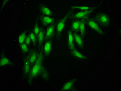 Immunofluorescence staining of Hela cells with AHNAK Antibody at 1:166, counter-stained with DAPI. The cells were fixed in 4% formaldehyde, permeabilized using 0.2% Triton X-100 and blocked in 10% normal Goat Serum. The cells were then incubated with the antibody overnight at 4°C. The secondary antibody was Alexa Fluor 488-congugated AffiniPure Goat Anti-Rabbit IgG(H+L).Rabbit anti-Human AHNAK Polyclonal Antibody
