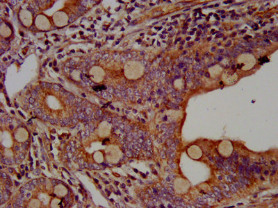IHC image of the antibody diluted at 1:500 and staining in paraffin-embedded human small intestine tissue performed on a Leica BondTM system. After dewaxing and hydration, antigen retrieval was mediated by high pressure in a citrate buffer (pH 6.0). Section was blocked with 10% normal goat serum 30min at RT. Then primary antibody (1% BSA) was incubated at 4°C overnight. The primary is detected by a biotinylated secondary antibody and visualized using an HRP conjugated SP system.Rabbit anti-Human AHNAK Polyclonal Antibody