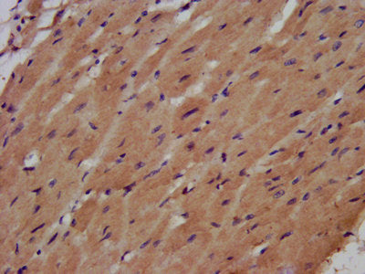 IHC image of AHNAK Antibody diluted at 1:500 and staining in paraffin-embedded human heart tissue performed on a Leica BondTM system. After dewaxing and hydration, antigen retrieval was mediated by high pressure in a citrate buffer (pH 6.0). Section was blocked with 10% normal goat serum 30min at RT. Then primary antibody (1% BSA) was incubated at 4°C overnight. The primary is detected by a biotinylated secondary antibody and visualized using an HRP conjugated SP system.Rabbit anti-Human AHNAK Polyclonal Antibody