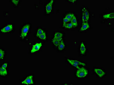 Immunofluorescent analysis of HepG2 cells using UNC79 Antibody at dilution of 1:100 and Alexa Fluor 488-congugated AffiniPure Goat Anti-Rabbit IgG(H+L)Rabbit anti-Human UNC79 Polyclonal Antibody