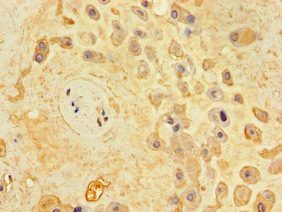 Immunohistochemistry of paraffin-embedded human placenta tissue using the antibody at dilution of 1:100Rabbit anti-Human UNC79 Polyclonal Antibody