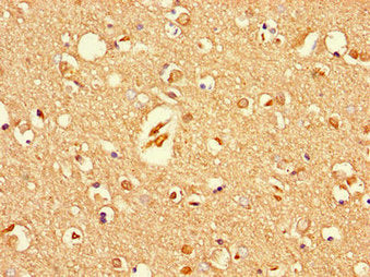 Immunohistochemistry of paraffin-embedded human brain tissue using UNC79 Antibody at dilution of 1:100Rabbit anti-Human UNC79 Polyclonal Antibody